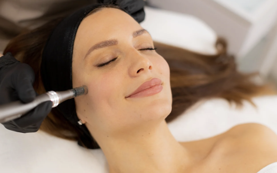 RF Microneedling With Morpheus8 in Rockville, Maryland for Skin Tightening